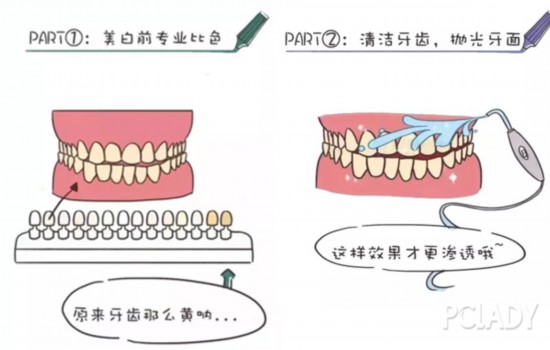 幾乎每個妹子都心動的冷光美牙，你確定能做嗎？