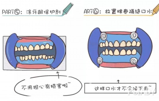 幾乎每個妹子都心動的冷光美牙，你確定能做嗎？